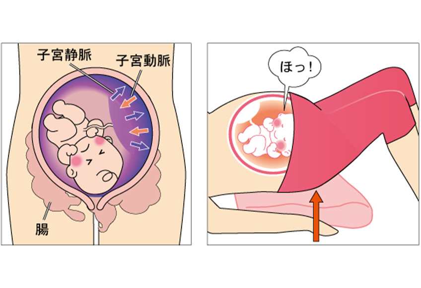 骨盤ケアとトコちゃんベルト