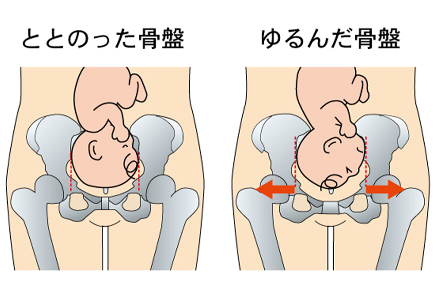 骨盤ケアとトコちゃんベルト