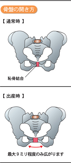 骨盤矯正