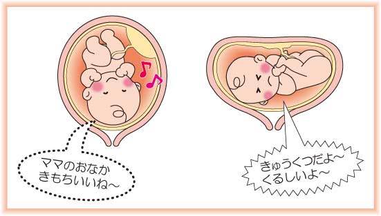 妊娠中(マタニティ)のあなたへ
