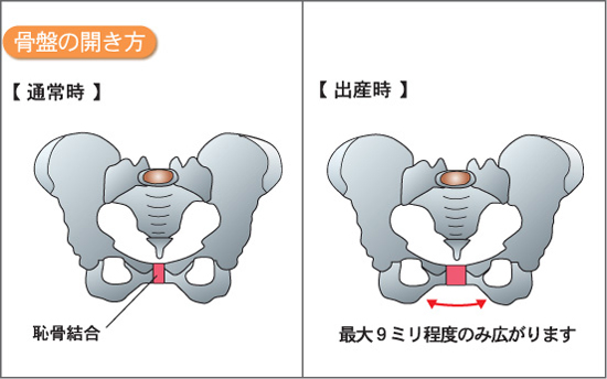 骨盤矯正